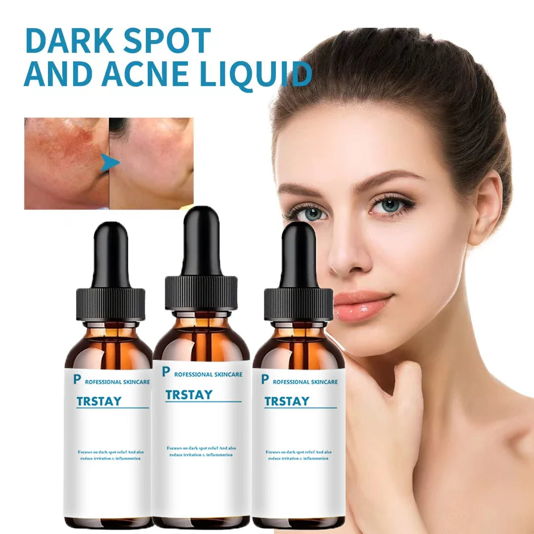 Retinol Serum Anti Wrinkle Facial Serum Anti Aging Fade Dark Spots Vitamin C Skincare-0